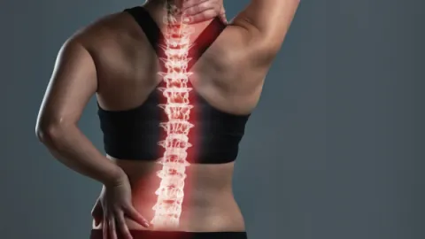 Escoliose: como identificar e tratar esse desvio postural?