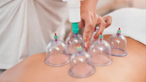 Ventosaterapia: o que é e para que serve esse tratamento?