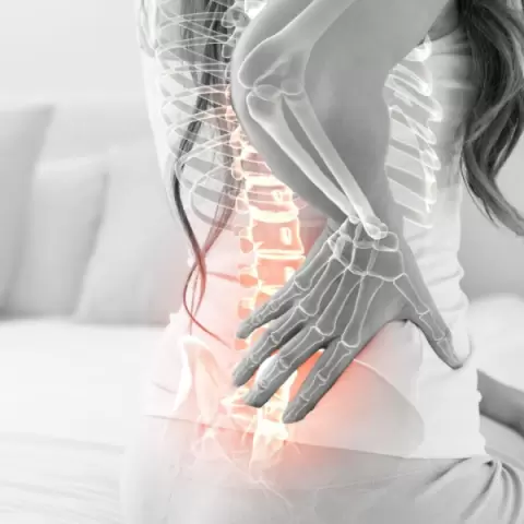 Imagem representativa: Hérnia de Disco Exame de Ressonância